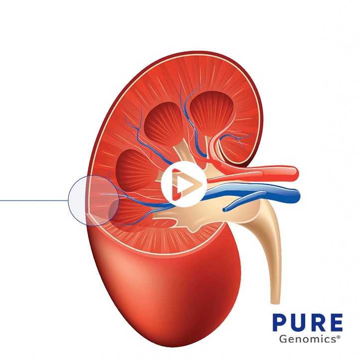 Salt Sensitivity Trait Tutorial - Thumbnail